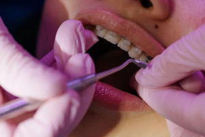Ortodoncia en las Rozas